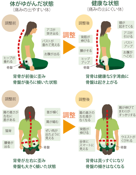 ゆがんだ状態と健康な状態